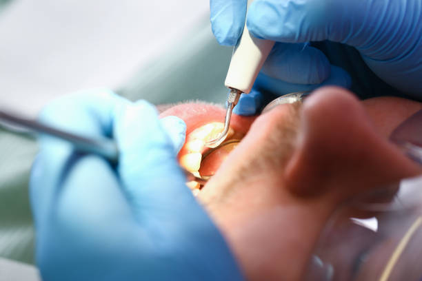 Best Cosmetic Emergency Dentistry in Douglasville, GA