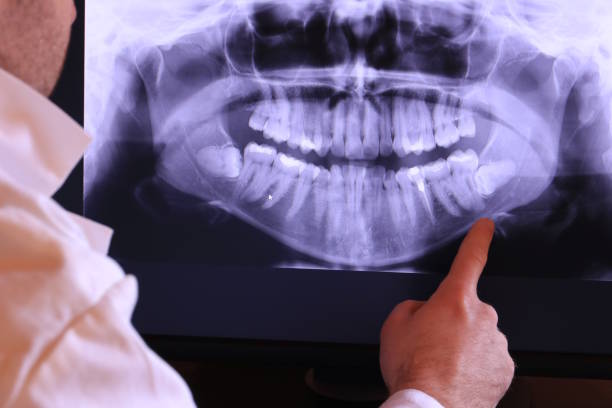 Best Urgent Care for Lost Fillings or Crowns in Douglasville, GA